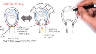 Obstetrics  Stage I of Labour [upl. by Baily355]