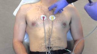 12 Lead ECG Placement example [upl. by Emmons]