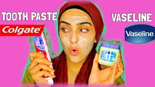 I APPLIED TOOTHPASTE AND VASELINE ON MY FACE  Look What Happened   Immy [upl. by Jacklyn196]