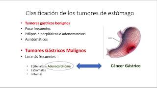 Cáncer Gástrico Generalidades Clínica y Diagnóstico [upl. by Mccord]