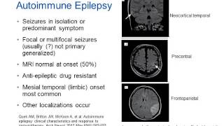 Infectious Encephalitis  My Brain and Medicine 2019  Dr Sylviane Defres [upl. by Benildis140]