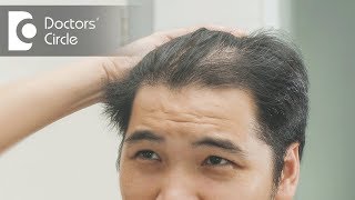 How to treat hair thinning in front part of the scalp  Dr Nischal K [upl. by Oys801]