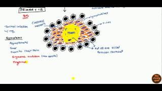 Tuberculosis for USMLE Step 1 and USMLE Step 2 [upl. by Nycila]