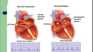 CARDIOLOGIE L’électrocardiogramme [upl. by Enyaj]