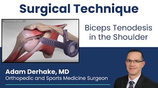 Biceps Tenodesis in the Shoulder Surgical Technique [upl. by Ryder590]