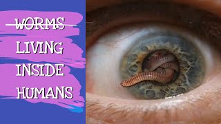 WORMS LIVING INSIDE HUMANS  EXPLAINED [upl. by Anat]