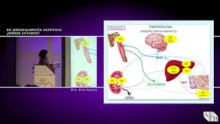 Encefalopatía Hepática dónde estamos [upl. by Acired]