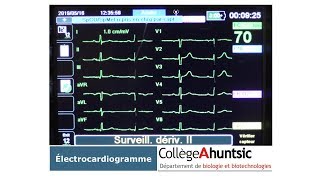 Le coeur Lélectrocardiogramme ECG [upl. by Nanete]