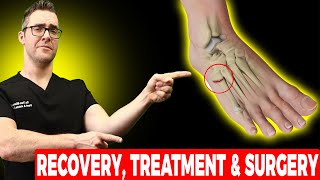 5th Metatarsal Jones Fracture Recovery Treatment amp Surgery [upl. by Noid]