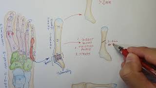 5th Metatarsal bone fractures explained [upl. by Prudy]