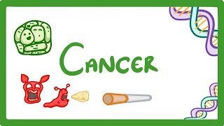 GCSE Biology  What is Cancer Benign and Malignant Tumours Explained 43 [upl. by Ecirtnuahs]