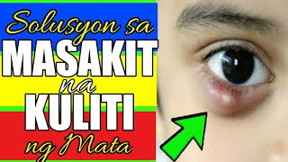 PINAKA MABISANG GAMOT SA KULITI o BUTLIG sa MATA TANGGAL PANGANGATI NG TALUKAP AT IMPEKSIYON [upl. by Reehsab]