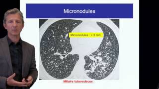 ECN PID cours 1 DFASM1 Diagnostic des PID Pr V Cottin Lyon [upl. by Kumler]