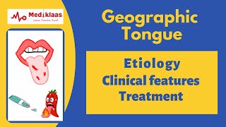 Geographic tongue Benign Migratory Glossitis [upl. by Leanatan]