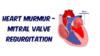 Mitral Regurgitation  Auscultation Sound [upl. by Notsuoh]