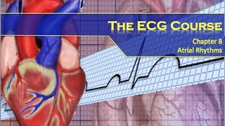 The ECG Course  Atrial Rhythms [upl. by Tabina]