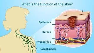 Understanding Melanoma [upl. by Edgard]