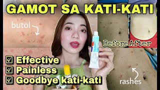 MABISANG GAMOT SA KATI KATI NG BALAT o KATAWAN  Rashes Pantal Butol Buni Insect bites amp Skinallergy [upl. by Blight330]