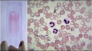 Blood Smear Preparation and Staining Practical Lab [upl. by Naashar]