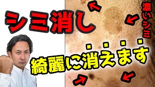 濃いシミも消す一番の方法はこれ！昔の美肌が蘇る。【化粧品原料のプロが解説】 [upl. by Meadow]