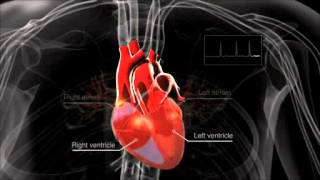 What is atrial fibrillation [upl. by Fabria]