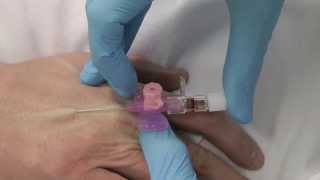 Cannulation How to gain IV access [upl. by Hamilton]