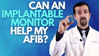 Can an Implantable Monitor Help my AFib  Dr Afib [upl. by Wileen866]