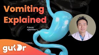 What Happens During Vomiting  The GutDr Explains 3D Gut Animation [upl. by Gnolb]