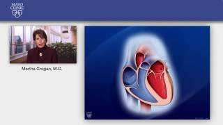 AMYLOIDOSIS PART 3 Morphology Diagnosis Special stains clinical features amp Prognosis [upl. by Durwood]