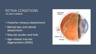 Demystifying Retinal Diseases [upl. by Trixy]