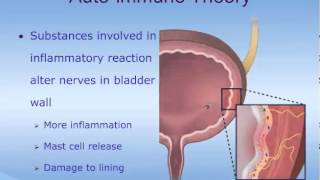 Understanding Interstitial Cystitis IC [upl. by Lean]