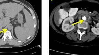 Introduction to Radiology Computed Tomography [upl. by Johnath]