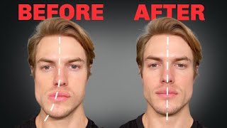 How to Fix Asymmetrical Jaw amp Face FOREVER [upl. by Jareb]