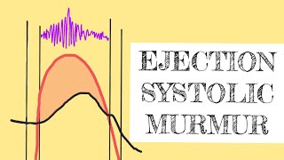 Ejection systolic murmur [upl. by Coppinger]