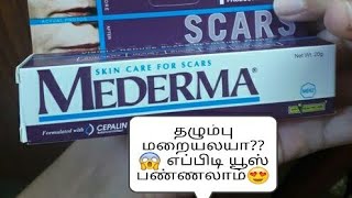 mederma advanced scar gel review in tamil [upl. by Bonine]