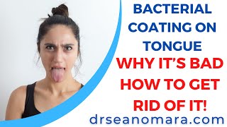 Bacterial Coating on Tongue Why it’s Bad How to Get Rid of It [upl. by Adnim31]