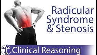 Lumbar Radicular Syndrome vs Intermittent Neurogenic ClaudicationStenosis [upl. by Johnny127]