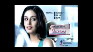 Mederma Scar Treatment  TVC  marks from stitches [upl. by Yud]