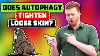 Autophagy Loose Skin How AUTOPHAGY TIGHTENS YOUR SKIN with FASTING [upl. by Eisdnyl711]