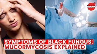 Symptoms of Black Fungus Mucormycosis Explained  BOOM  What Is Black Fungus  COVID19 in India [upl. by Aibat]