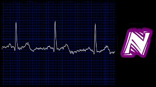 Sonido de monitor cardiaco  Heart monitor sound effect  Ekg sound  Sonido electrocardiograma [upl. by Anidene]