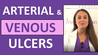 Arterial Ulcers vs Venous Ulcers Nursing Characteristics for PVD Peripheral Vascular Disease [upl. by Hannaoj]