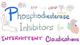 Intermittent Claudications Management [upl. by Felicity103]