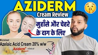 Aziderm 20 Cream Review  Cream For Melasma amp Acne [upl. by Eiuqnom706]