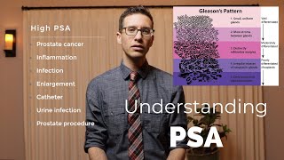 What PSA is and why its important explained by urologist [upl. by Hsatan]