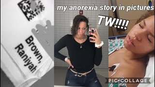 my anorexia story TW [upl. by Nrobyalc502]