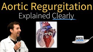 Mitral Valve Stenosis Diagnosis Treatment Pathophysiology [upl. by Ahtaga]