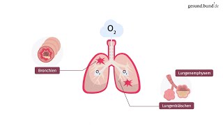 Was ist eine chronisch obstruktive Lungenerkrankung COPD [upl. by Drwde]