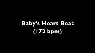 Fetal Heart Beat Audio 11 Weeks Pregnant [upl. by Frayne]