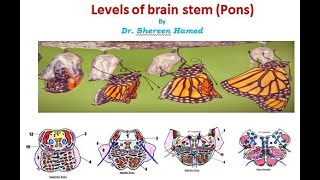 practical brain stem levels pons [upl. by Tehr]